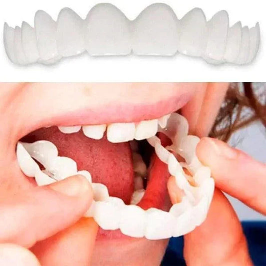 SmilePro – Carillas Dentales Ajustables con Estuche